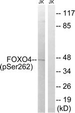 Phospho-FOXO4 (Ser262) Antibody in Western Blot (WB)