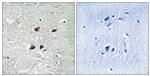 Phospho-HSF1 (Ser121) Antibody in Immunohistochemistry (Paraffin) (IHC (P))