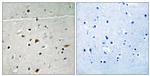 Phospho-LIMK2 (Ser283) Antibody in Immunohistochemistry (Paraffin) (IHC (P))
