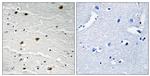 Phospho-AKT Pan (Tyr315, Tyr316, Tyr312) Antibody in Immunohistochemistry (Paraffin) (IHC (P))