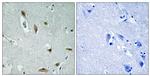 Phospho-AKT1/AKT3 (Tyr437, Tyr434) Antibody in Immunohistochemistry (Paraffin) (IHC (P))