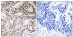 Phospho-A-Raf (Ser299) Antibody in Immunohistochemistry (Paraffin) (IHC (P))