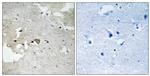 Phospho-Axl (Tyr691) Antibody in Immunohistochemistry (Paraffin) (IHC (P))