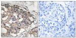 Phospho-B-Raf (Ser446) Antibody in Immunohistochemistry (Paraffin) (IHC (P))