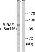 Phospho-B-Raf (Ser446) Antibody in Western Blot (WB)