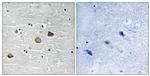 Phospho-CaMKII beta/gamma/delta (Thr287) Antibody in Immunohistochemistry (Paraffin) (IHC (P))