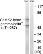 Phospho-CaMKII beta/gamma/delta (Thr287) Antibody in Western Blot (WB)