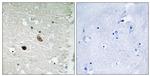 CaMKII beta/gamma/delta Antibody in Immunohistochemistry (Paraffin) (IHC (P))