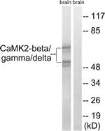 CaMKII beta/gamma/delta Antibody in Western Blot (WB)