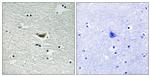 Phospho-CK1 alpha (Tyr294) Antibody in Immunohistochemistry (Paraffin) (IHC (P))