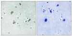 CK1 gamma Antibody in Immunohistochemistry (Paraffin) (IHC (P))