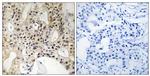 LATS1/LATS2 Antibody in Immunohistochemistry (Paraffin) (IHC (P))