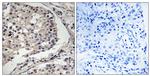 MLK1/MLK2 Antibody in Immunohistochemistry (Paraffin) (IHC (P))