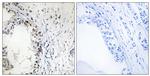 Phospho-MNK1 (Thr250) Antibody in Immunohistochemistry (Paraffin) (IHC (P))