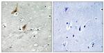 Phospho-MSK2 (Thr568) Antibody in Immunohistochemistry (Paraffin) (IHC (P))