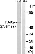 Phospho-PAK2 (Ser192) Antibody in Western Blot (WB)