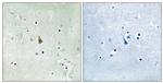 Phospho-TrkC (Tyr516) Antibody in Immunohistochemistry (Paraffin) (IHC (P))