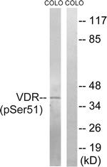 Phospho-VDR (Ser51) Antibody in Western Blot (WB)
