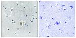 Phospho-Bim (Ser59) Antibody in Immunohistochemistry (Paraffin) (IHC (P))