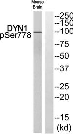 Phospho-Dynamin 1 (Ser778) Antibody in Western Blot (WB)