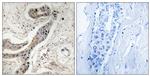 Phospho-Bcl-X (Thr115) Antibody in Immunohistochemistry (Paraffin) (IHC (P))
