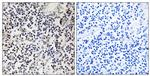 Phospho-Estrogen Receptor beta (Ser87) Antibody in Immunohistochemistry (Paraffin) (IHC (P))