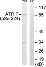 Phospho-ATRIP (Ser224) Antibody in Western Blot (WB)