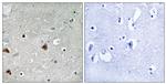 Phospho-GPS1 (Ser454) Antibody in Immunohistochemistry (Paraffin) (IHC (P))