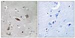 Phospho-Doublecortin (Ser376) Antibody in Immunohistochemistry (Paraffin) (IHC (P))
