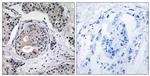 Phospho-EEF2K (Ser359) Antibody in Immunohistochemistry (Paraffin) (IHC (P))