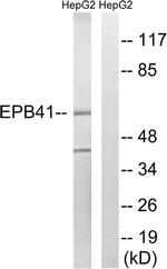 EPB41 Antibody in Western Blot (WB)