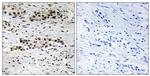 Phospho-Estrogen Receptor alpha (Ser102) Antibody in Immunohistochemistry (Paraffin) (IHC (P))