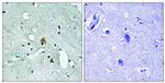 Phospho-IP3 Receptor 1 (Ser1764) Antibody in Immunohistochemistry (Paraffin) (IHC (P))