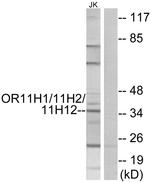 OR11H1/OR11H2/OR11H12 Antibody in Western Blot (WB)