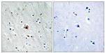 Phospho-MAPKAPK2 (Ser272) Antibody in Immunohistochemistry (Paraffin) (IHC (P))