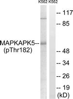 Phospho-PRAK (Thr182) Antibody in Western Blot (WB)