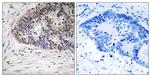 Phospho-MDMX (Ser367) Antibody in Immunohistochemistry (Paraffin) (IHC (P))