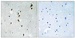 Phospho-MNK1 (Thr385) Antibody in Immunohistochemistry (Paraffin) (IHC (P))