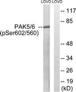 Phospho-PAK5/PAK6 (Ser602, Ser560) Antibody in Western Blot (WB)