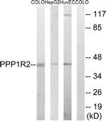 PPP1R2 Antibody in Western Blot (WB)