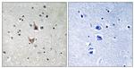 Phospho-Presenilin 1 (Ser357) Antibody in Immunohistochemistry (Paraffin) (IHC (P))