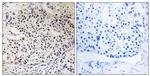 Phospho-RAD51 (Thr309) Antibody in Immunohistochemistry (Paraffin) (IHC (P))