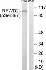 Phospho-RFWD2 (Ser387) Antibody in Western Blot (WB)