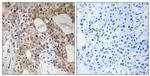 Phospho-SPHK2 (Thr614) Antibody in Immunohistochemistry (Paraffin) (IHC (P))