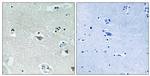 Phospho-SREBP1 (Ser439) Antibody in Immunohistochemistry (Paraffin) (IHC (P))