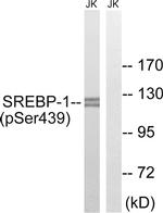 Phospho-SREBP1 (Ser439) Antibody in Western Blot (WB)