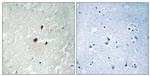 Phospho-RRN3 (Ser649) Antibody in Immunohistochemistry (Paraffin) (IHC (P))