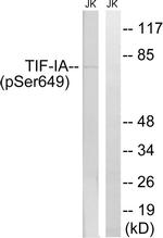 Phospho-RRN3 (Ser649) Antibody in Western Blot (WB)