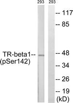 Phospho-THRB (Ser142) Antibody in Western Blot (WB)