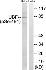 Phospho-UBF-1 (Ser484) Antibody in Western Blot (WB)